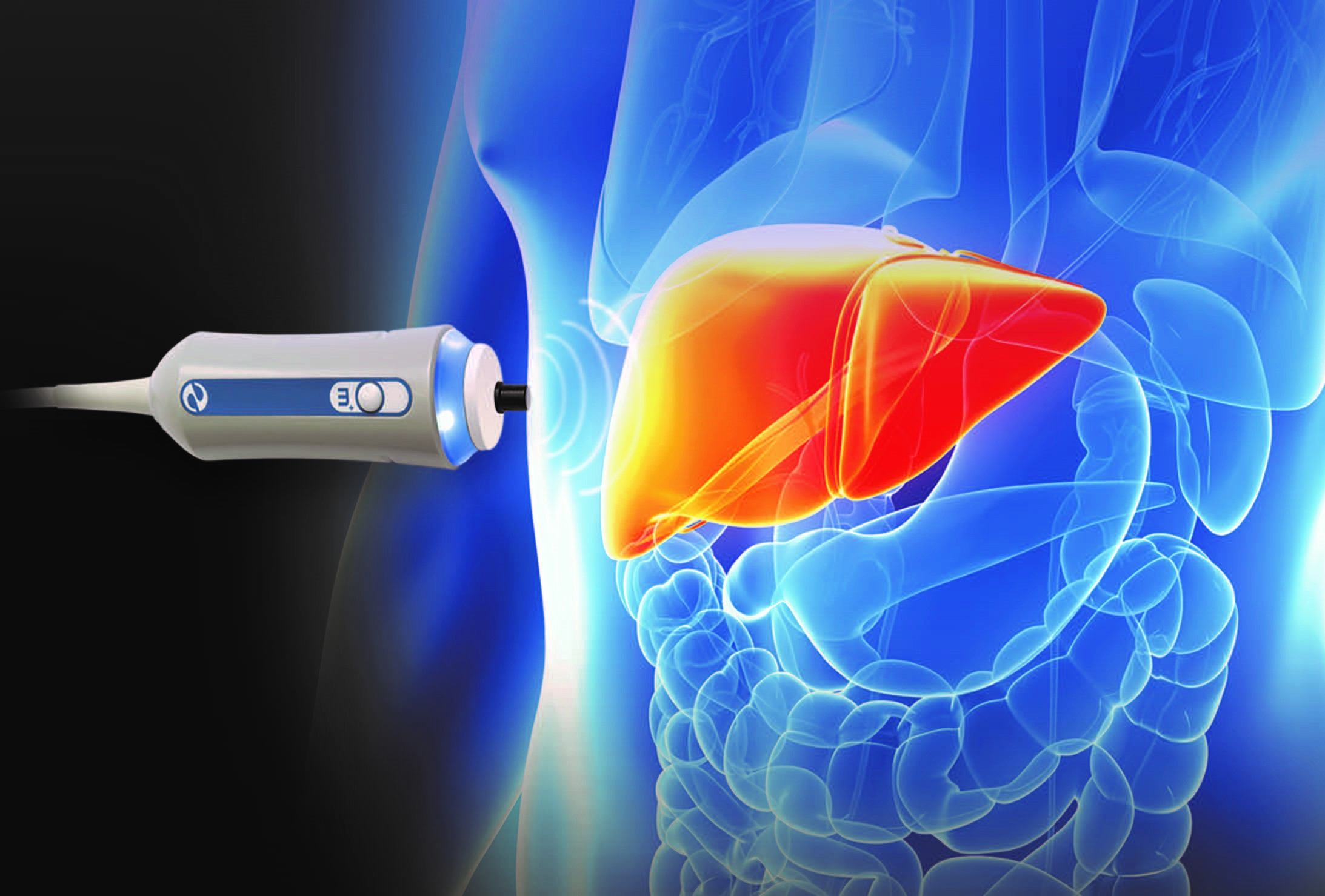 Fibroscan and Liver Health | Gastroenterology Associates of the ...